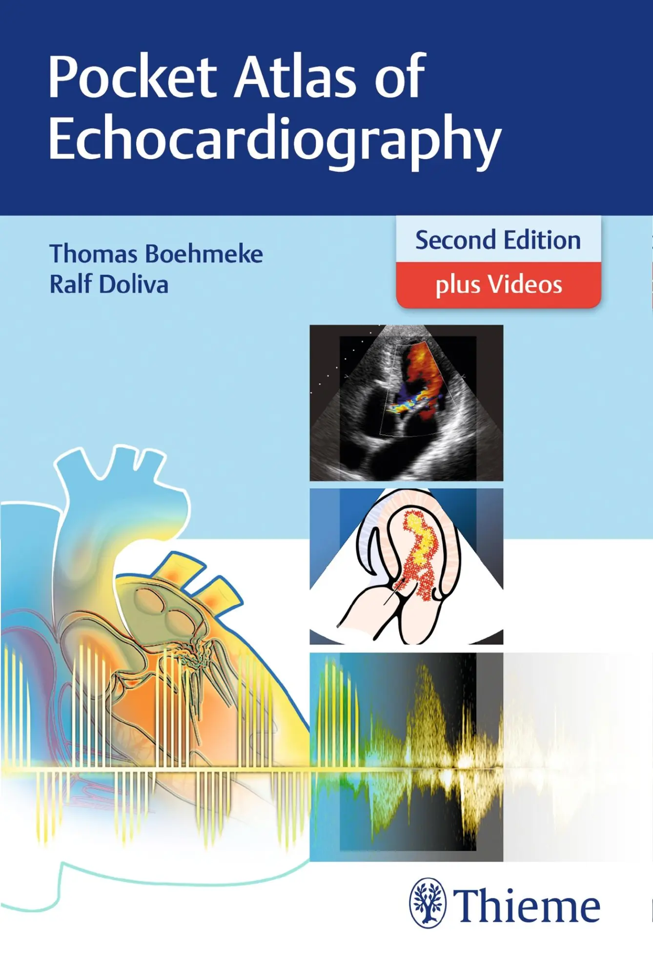 Pocket Atlas Of Echocardiography | Thomas BöHmeke (U. A.) | Englisch | Buch-image