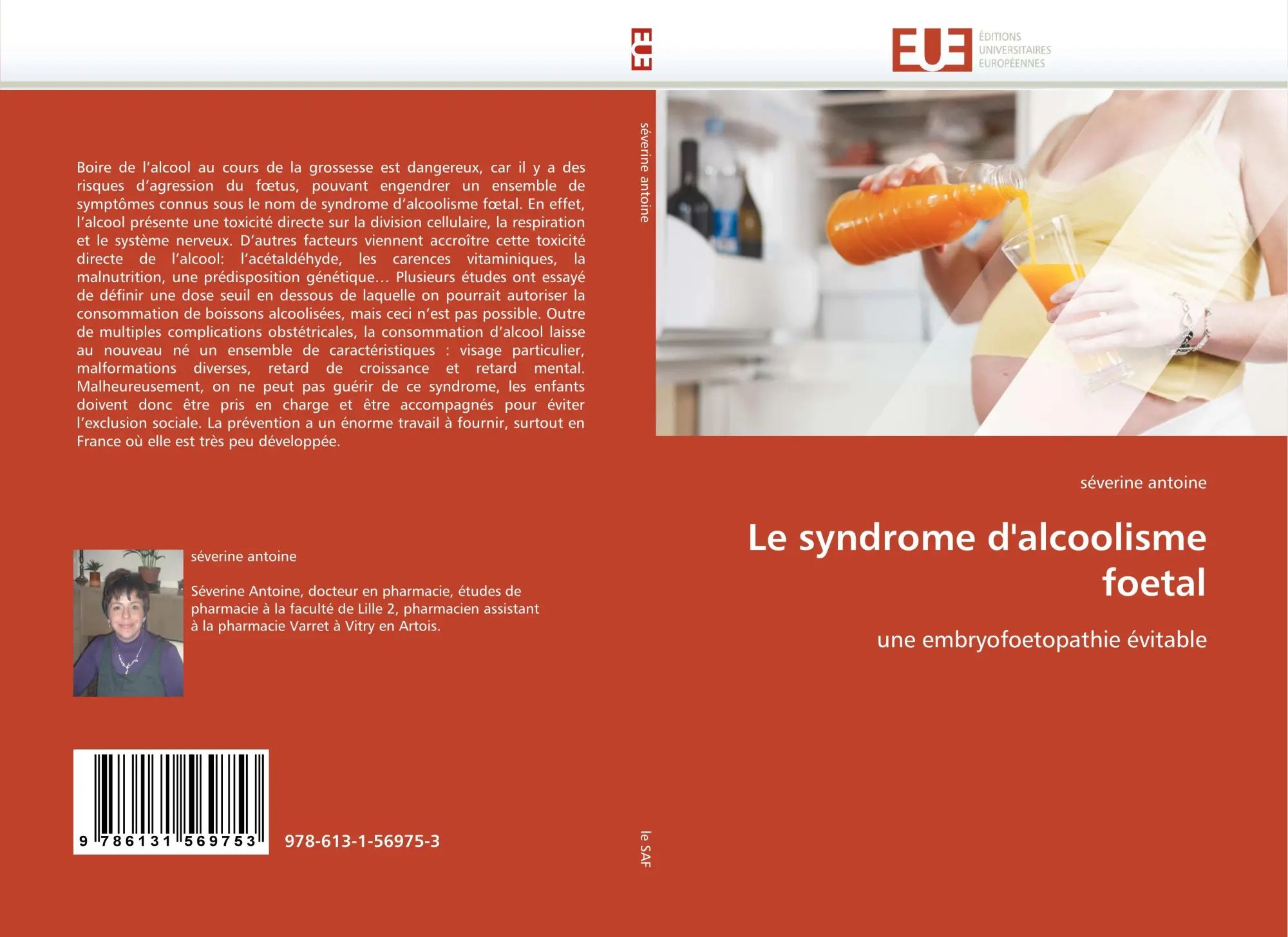Le syndrome d'alcoolisme foetal : une embryofoetopathie évitable : Séverine Antoine : Taschenbuch : 100 S. : Französisch : 2011 : Éditions universitaires européennes : EAN 9786131569753 - Antoine, Séverine